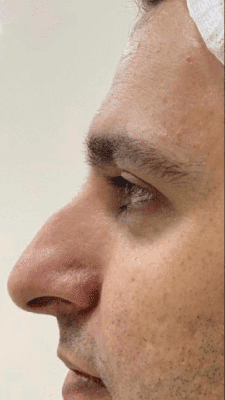 pedro-antes-3