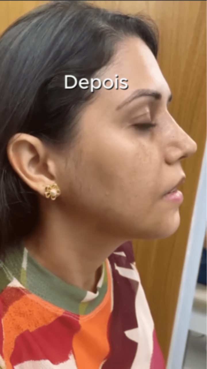 pedro-depois-2